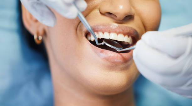 Best Emergency Broken Tooth Repair in Brownsville, LA